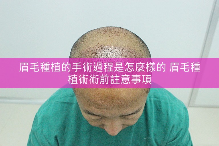 眉毛種植的手術過程是怎麼樣的 眉毛種植術術前註意事項