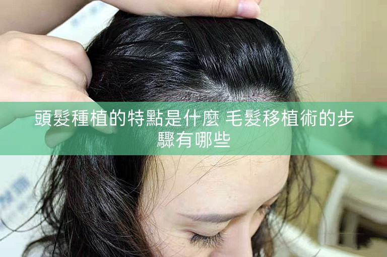 頭髮種植的特點是什麼 毛髮移植術的步驟有哪些