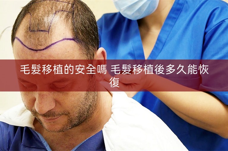 毛髮移植的安全嗎 毛髮移植後多久能恢復