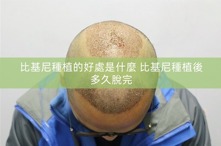 比基尼種植的好處是什麼 比基尼種植後多久脫完