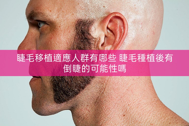 睫毛移植適應人群有哪些 睫毛種植後有倒睫的可能性嗎 睫毛移植適應人群有哪些 睫毛種植後有倒睫的可能性嗎