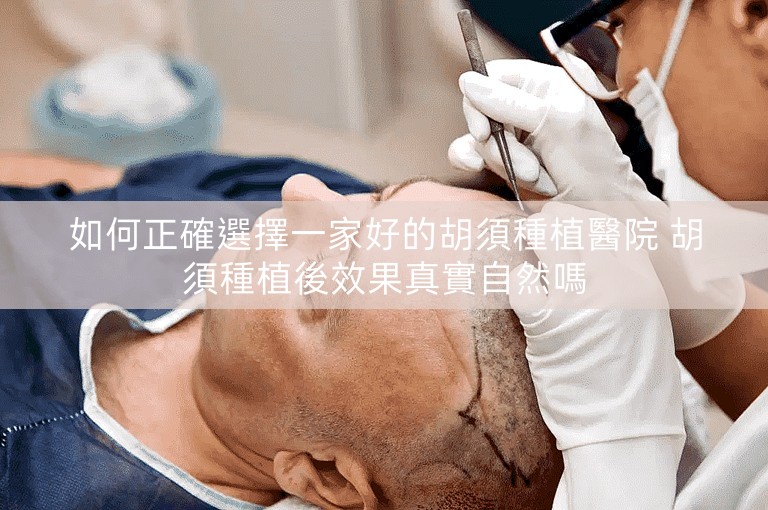 如何正確選擇一家好的胡須種植醫院 胡須種植後效果真實自然嗎