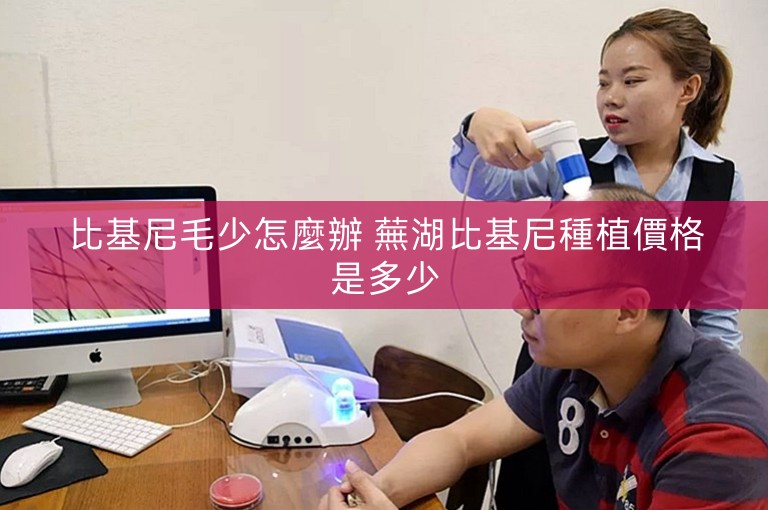 比基尼毛少怎麼辦 蕪湖比基尼種植價格是多少