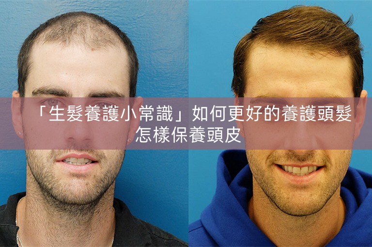 「生髮養護小常識」如何更好的養護頭髮 怎樣保養頭皮