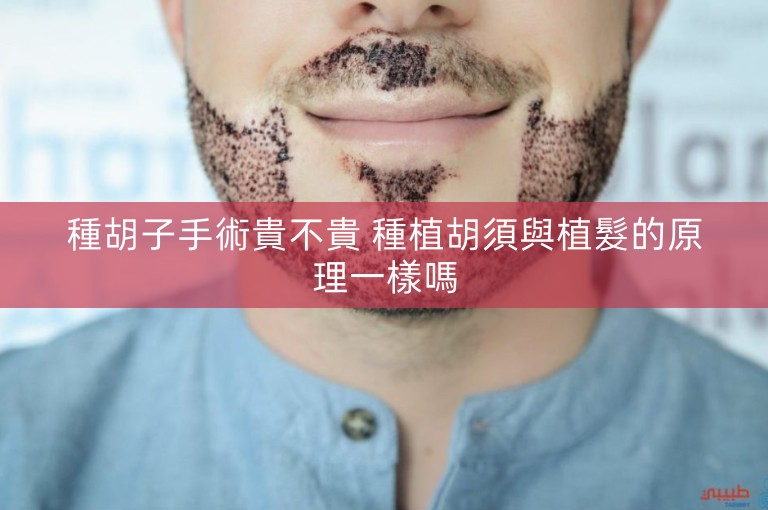 種胡子手術貴不貴 種植胡須與植髮的原理一樣嗎