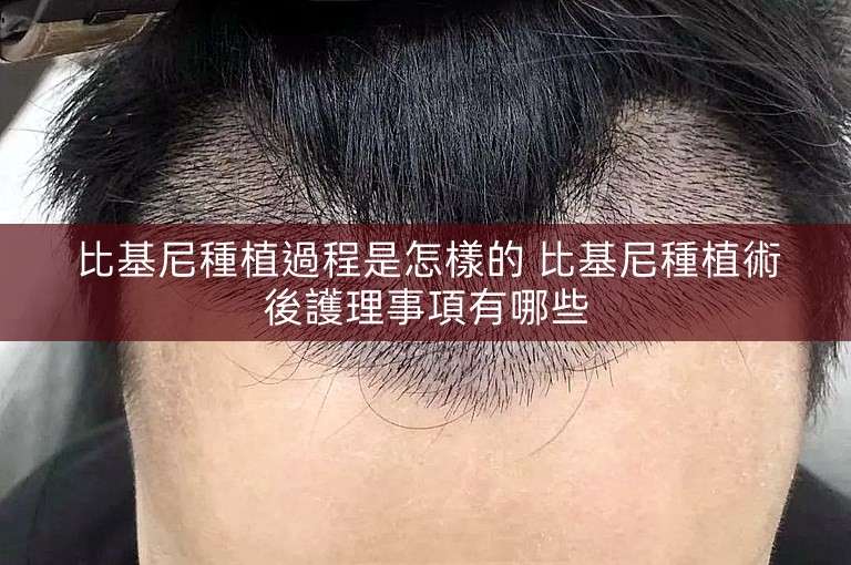 比基尼種植過程是怎樣的 比基尼種植術後護理事項有哪些