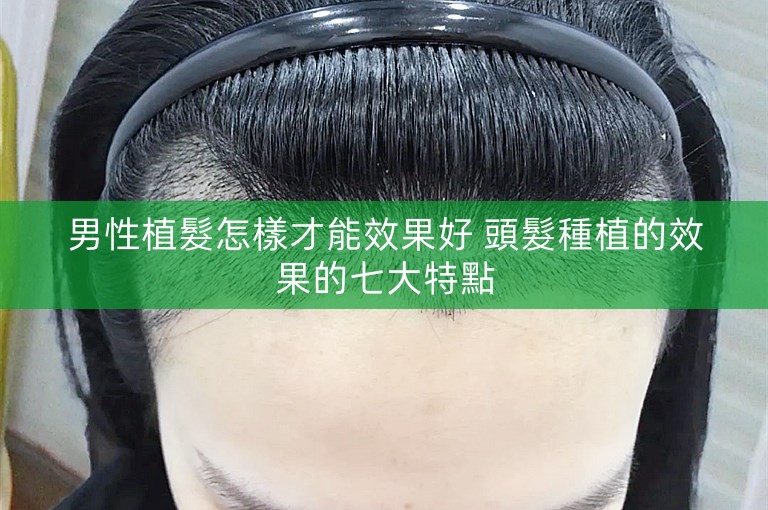 男性植髮怎樣才能效果好 頭髮種植的效果的七大特點