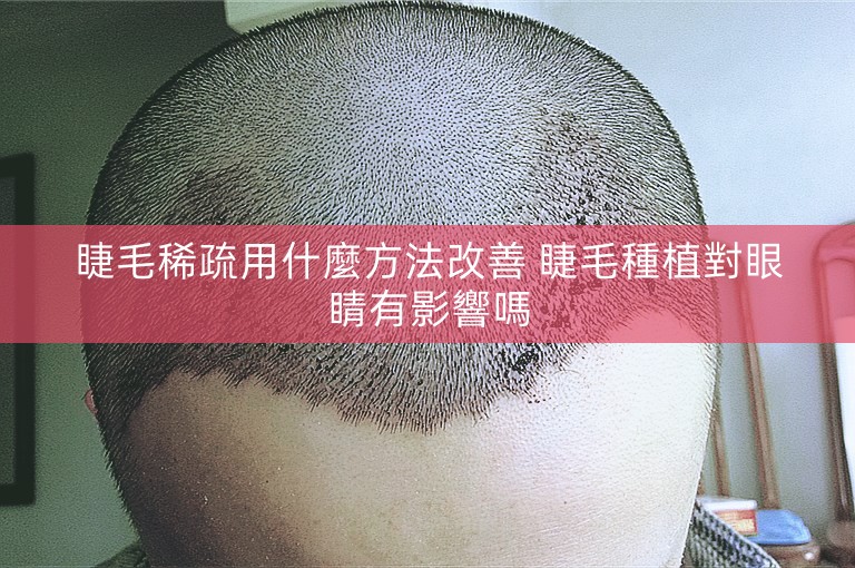 睫毛稀疏用什麼方法改善 睫毛種植對眼睛有影響嗎