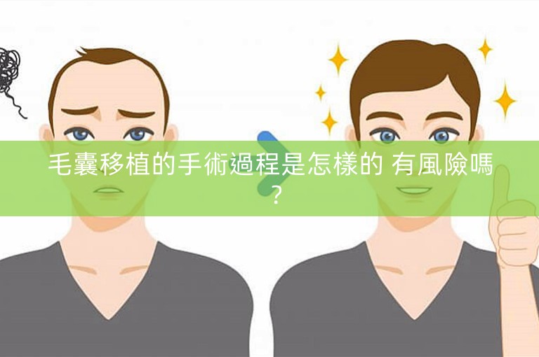 毛囊移植的手術過程是怎樣的 有風險嗎？