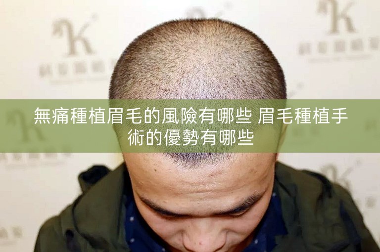 無痛種植眉毛的風險有哪些 眉毛種植手術的優勢有哪些