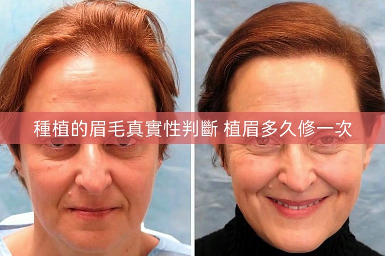 種植的眉毛真實性判斷 植眉多久修一次