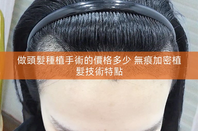 做頭髮種植手術的價格多少 無痕加密植髮技術特點