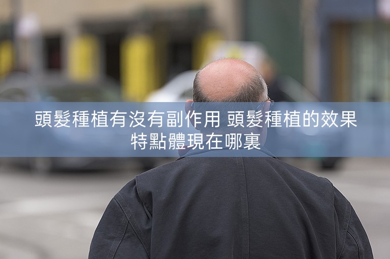 頭髮種植有沒有副作用 頭髮種植的效果特點體現在哪裏