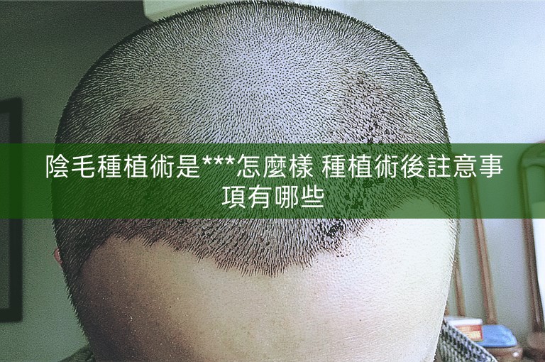 陰毛種植術是***怎麼樣 種植術後註意事項有哪些