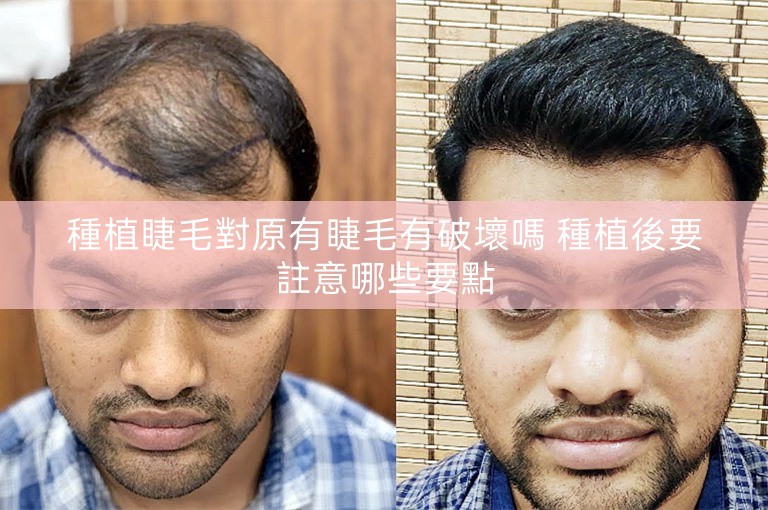 種植睫毛對原有睫毛有破壞嗎 種植後要註意哪些要點