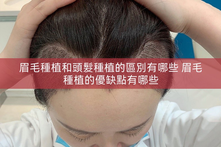 眉毛種植和頭髮種植的區別有哪些 眉毛種植的優缺點有哪些