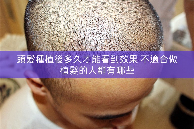 頭髮種植後多久才能看到效果 不適合做植髮的人群有哪些