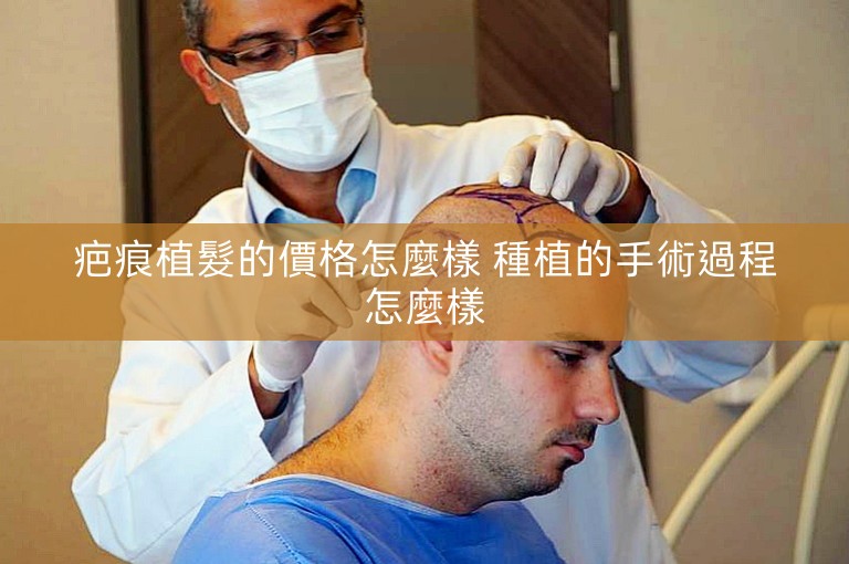 疤痕植髮的價格怎麼樣 種植的手術過程怎麼樣