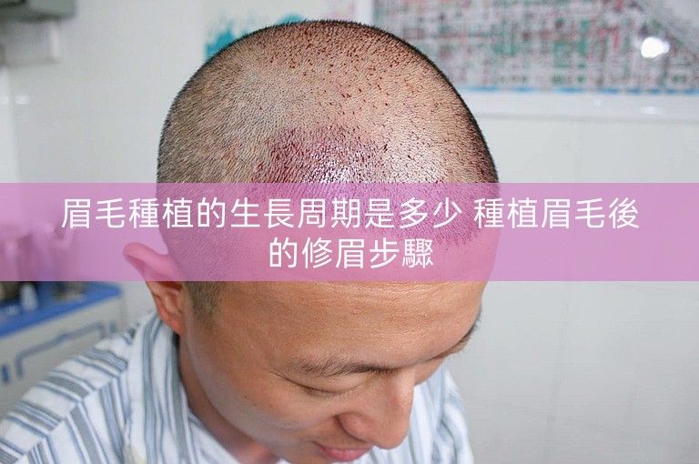 眉毛種植的生長周期是多少 種植眉毛後的修眉步驟