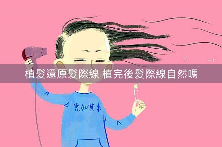 植髮還原髮際線 植完後髮際線自然嗎