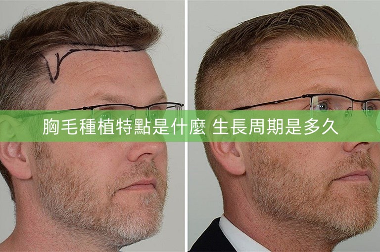 胸毛種植特點是什麼 生長周期是多久