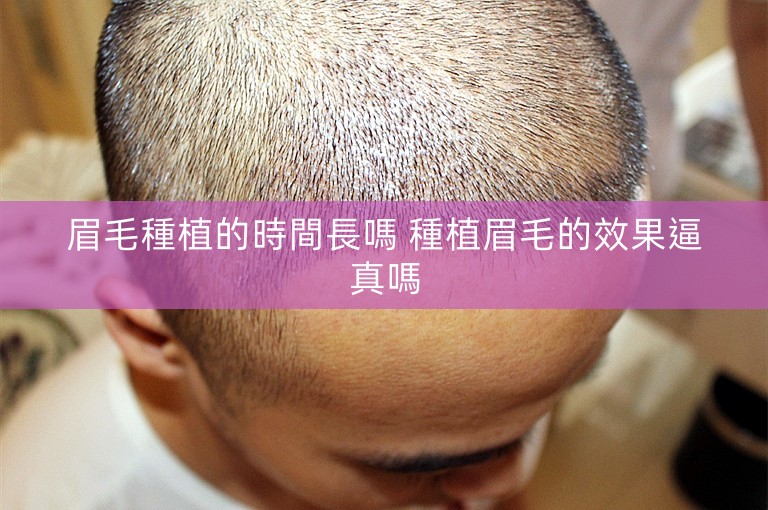 眉毛種植的時間長嗎 種植眉毛的效果逼真嗎