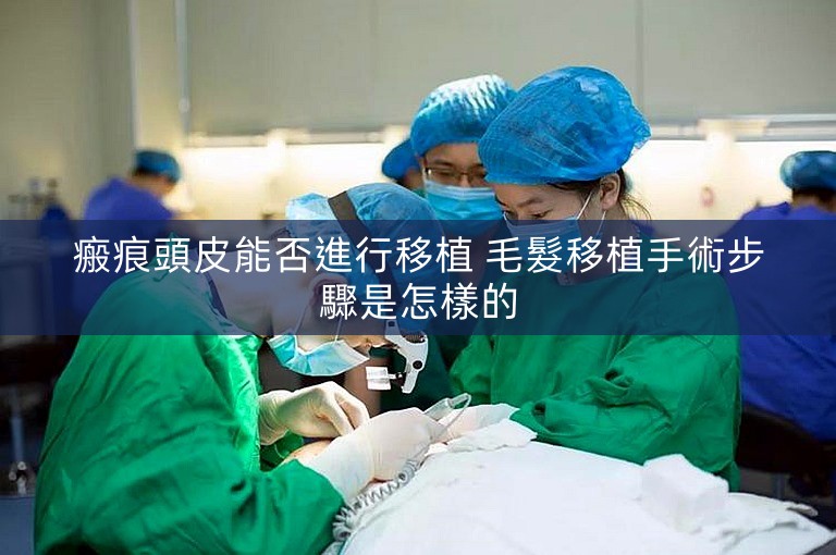 瘢痕頭皮能否進行移植 毛髮移植手術步驟是怎樣的
