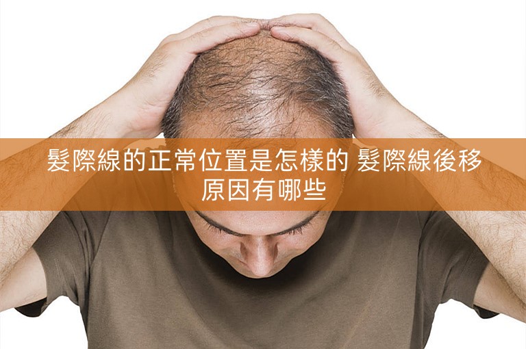 髮際線的正常位置是怎樣的 髮際線後移原因有哪些