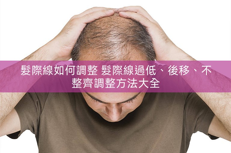 髮際線如何調整 髮際線過低、後移、不整齊調整方法大全 髮際線如何調整 髮際線過低、後移、不整齊調整方法大全
