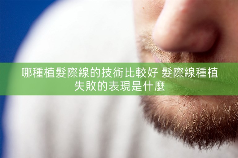 哪種植髮際線的技術比較好 髮際線種植失敗的表現是什麼