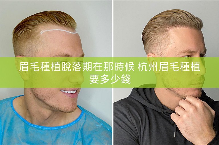 眉毛種植脫落期在那時候 杭州眉毛種植要多少錢
