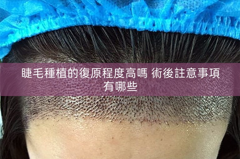 睫毛種植的復原程度高嗎 術後註意事項有哪些 睫毛種植的復原程度高嗎 術後註意事項有哪些