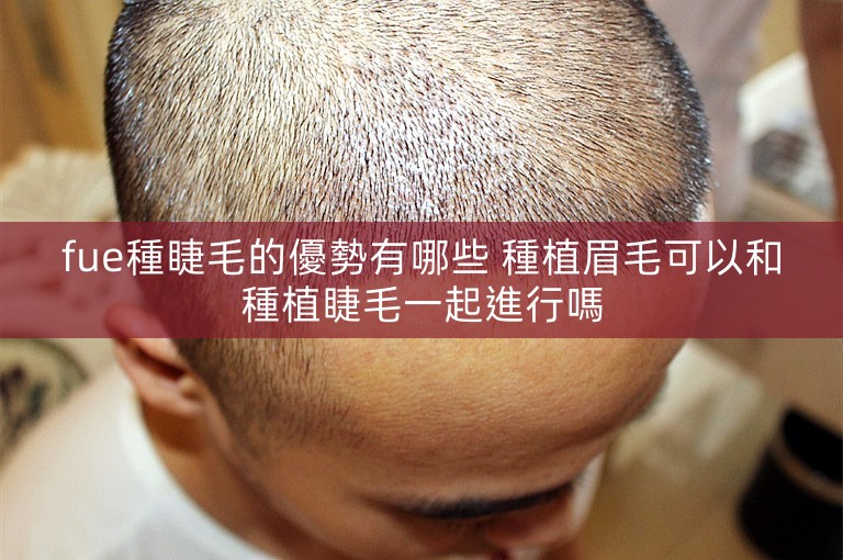 fue種睫毛的優勢有哪些 種植眉毛可以和種植睫毛一起進行嗎