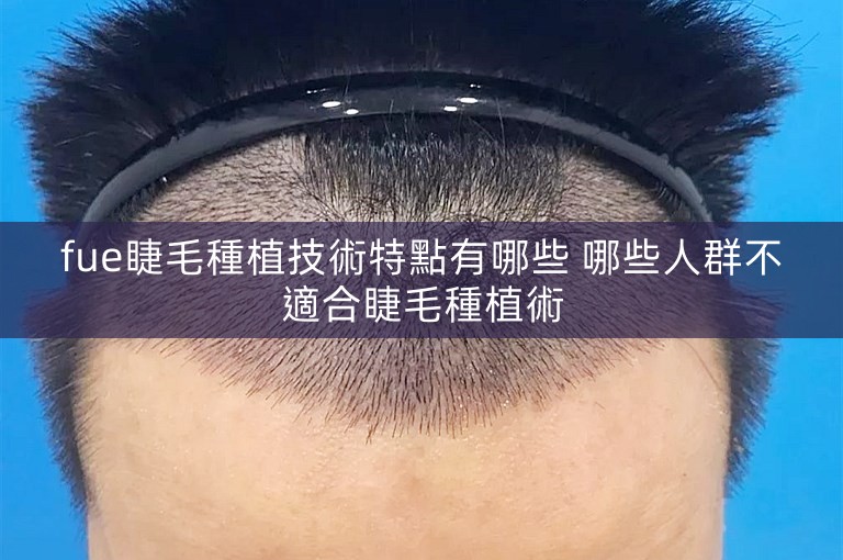 fue睫毛種植技術特點有哪些 哪些人群不適合睫毛種植術