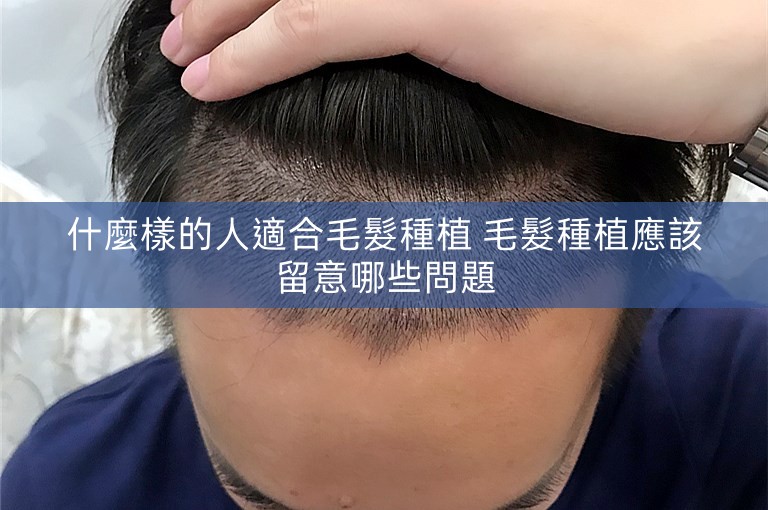 什麼樣的人適合毛髮種植 毛髮種植應該留意哪些問題