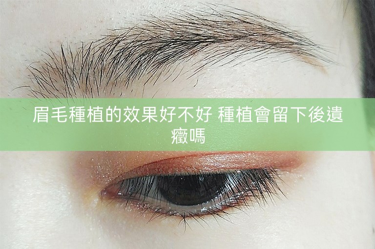 眉毛種植的效果好不好 種植會留下後遺癥嗎
