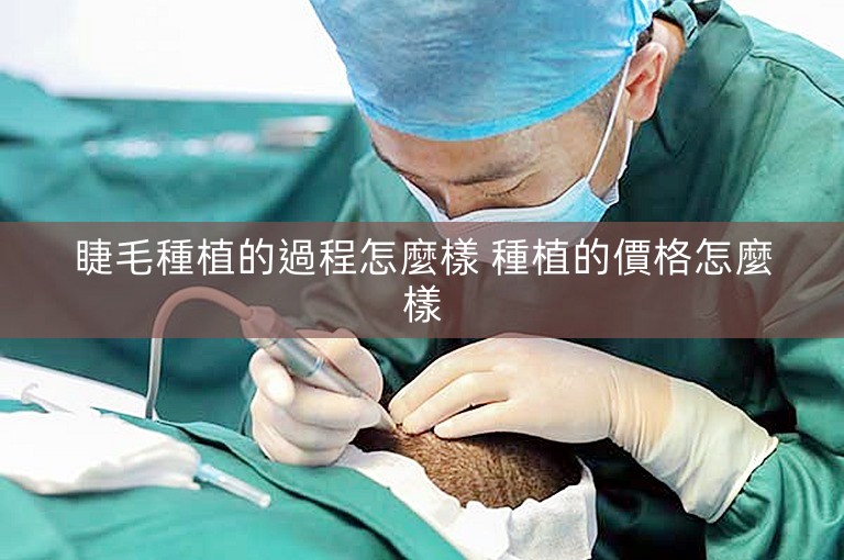睫毛種植的過程怎麼樣 種植的價格怎麼樣