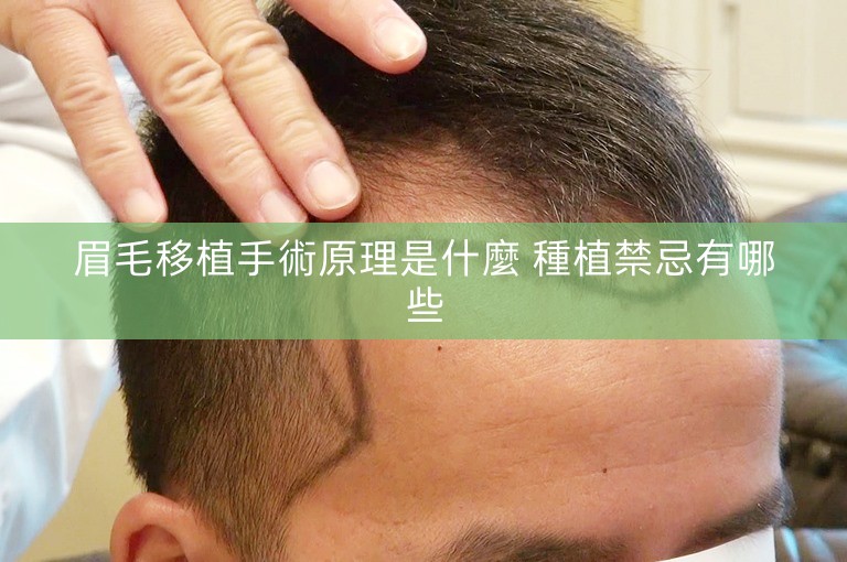 眉毛移植手術原理是什麼 種植禁忌有哪些