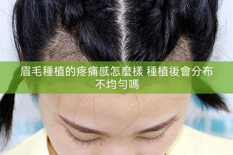 眉毛種植的疼痛感怎麼樣 種植後會分布不均勻嗎