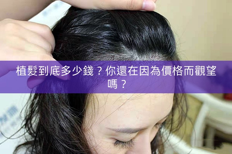 植髮到底多少錢？你還在因為價格而觀望嗎？