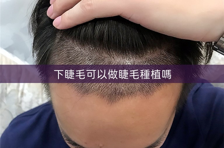 下睫毛可以做睫毛種植嗎