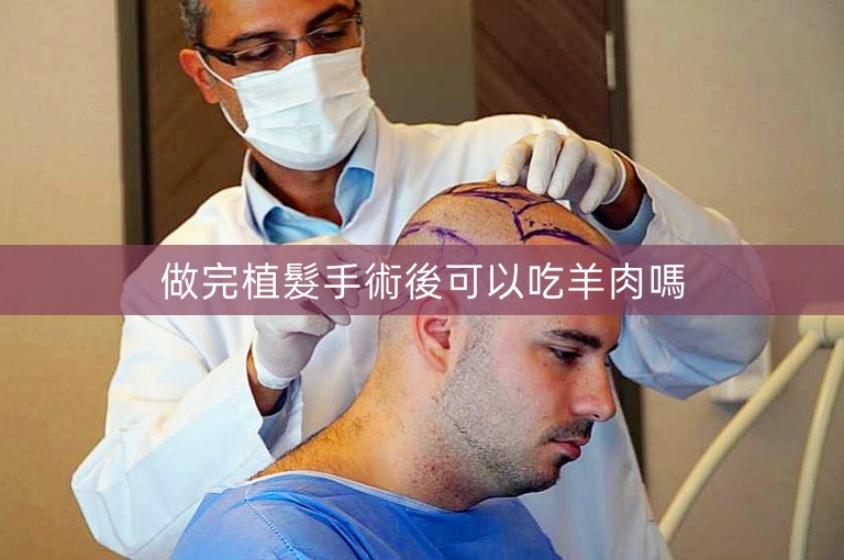 做完植髮手術後可以吃羊肉嗎