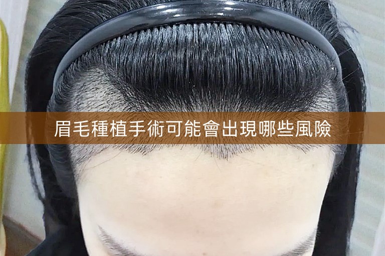 眉毛種植手術可能會出現哪些風險