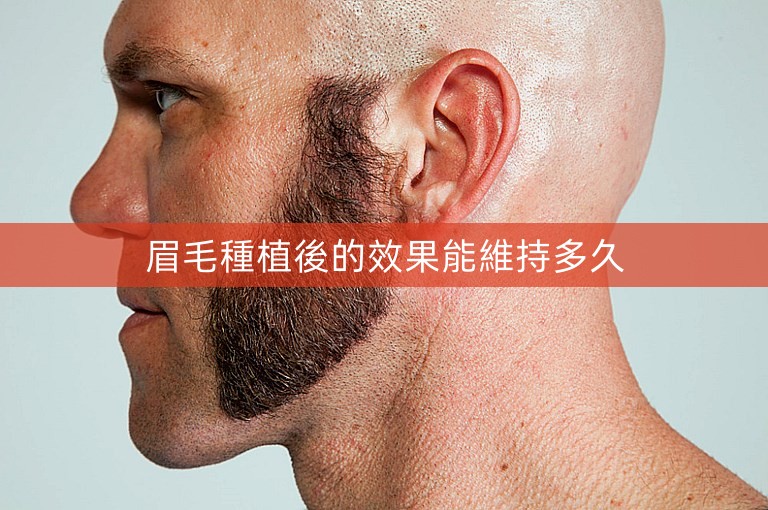 眉毛種植後的效果能維持多久