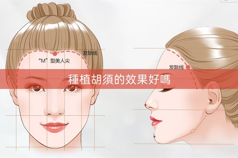 種植胡須的效果好嗎