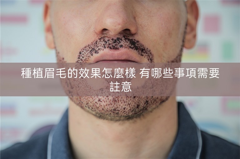 種植眉毛的效果怎麼樣 有哪些事項需要註意