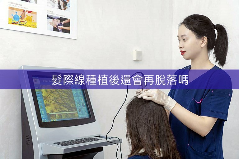 髮際線種植後還會再脫落嗎