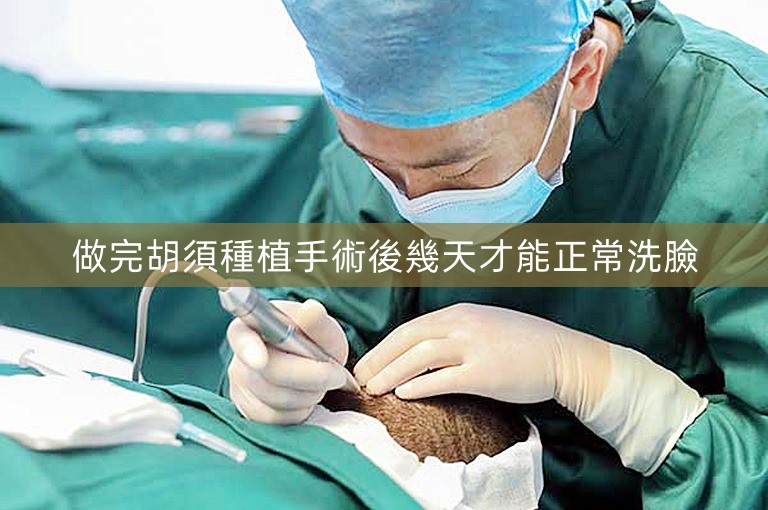 做完胡須種植手術後幾天才能正常洗臉