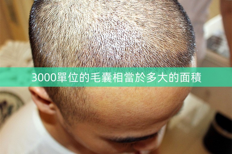 3000單位的毛囊相當於多大的面積