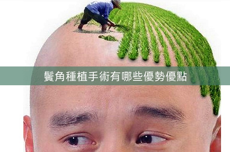 鬢角種植手術有哪些優勢優點